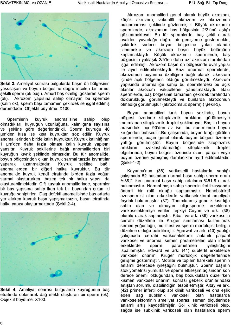 Akrozom yapısına sahip olmayan bu spermde (kalın ok), sperm başı tamamen çekirdek ile işgal edilmiş durumdadır. Objektif büyütme: X100.