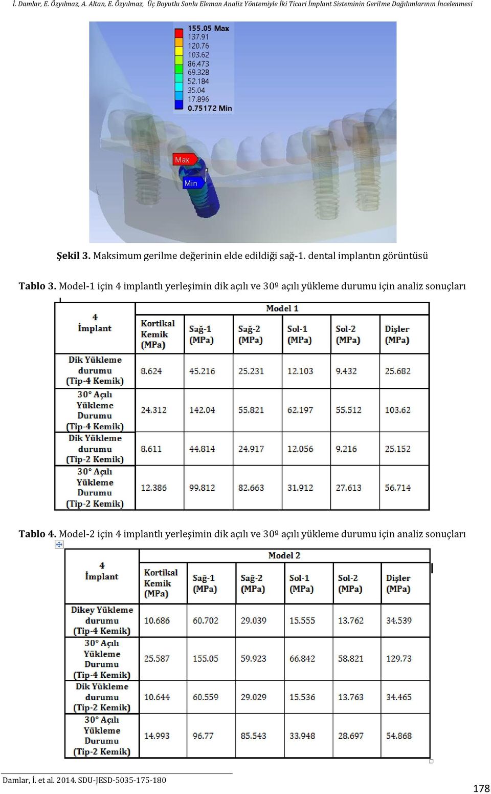 Model-1 için 4 implantlı yerleşimin dik açılı ve 30º açılı yükleme durumu