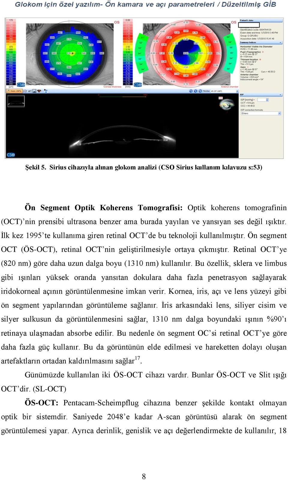 yansıyan ses değil ışıktır. İlk kez 1995 te kullanıma giren retinal OCT de bu teknoloji kullanılmıştır. Ön segment OCT (ÖS-OCT), retinal OCT nin geliştirilmesiyle ortaya çıkmıştır.