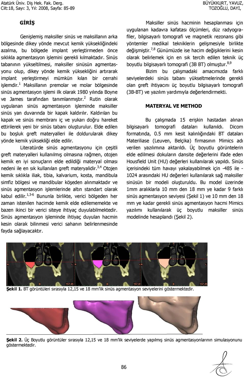 1 Maksillanın premolar ve molar bölgesinde sinüs agmentasyon işlemi ilk olarak 1980 yılında Boyne ve James tarafından tanımlanmıştır.