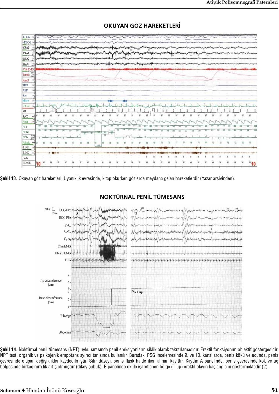 NOKTÜRNAL PENİL TÜMESANS 50µv L 2 sec LOC-FPz A B Tip circumference (cm) Base circumference (cm) 4 2 0 4 2 0 T up Şekil 14.