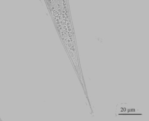 16 Rhynchophorus ferrugineus üzerinde entomopatojen nematod Heterorhabditis bacteriophora 1000 600 Şekil 1. Heterorhabditis bacteriophora nın D2/D3 bölgesinin PCR ürünü. Figure 1.