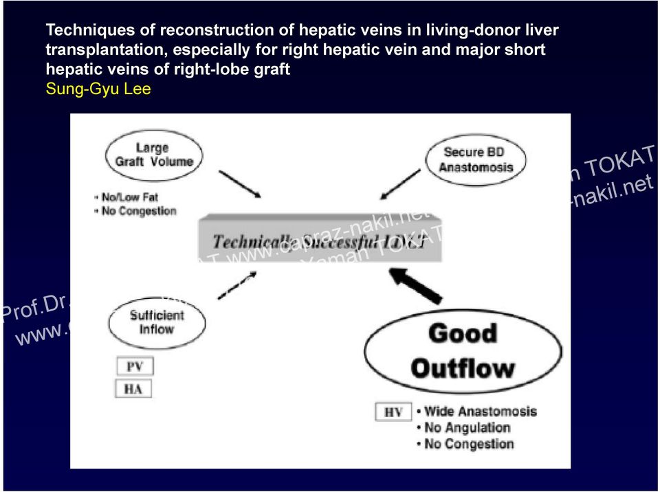 especially for right hepatic vein and major