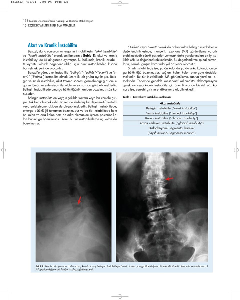 Bu bölümde, kronik instabilite ayr nt l olarak de erlendirildi i için akut instabiliteden k saca bahsetmek yerinde olacakt r.