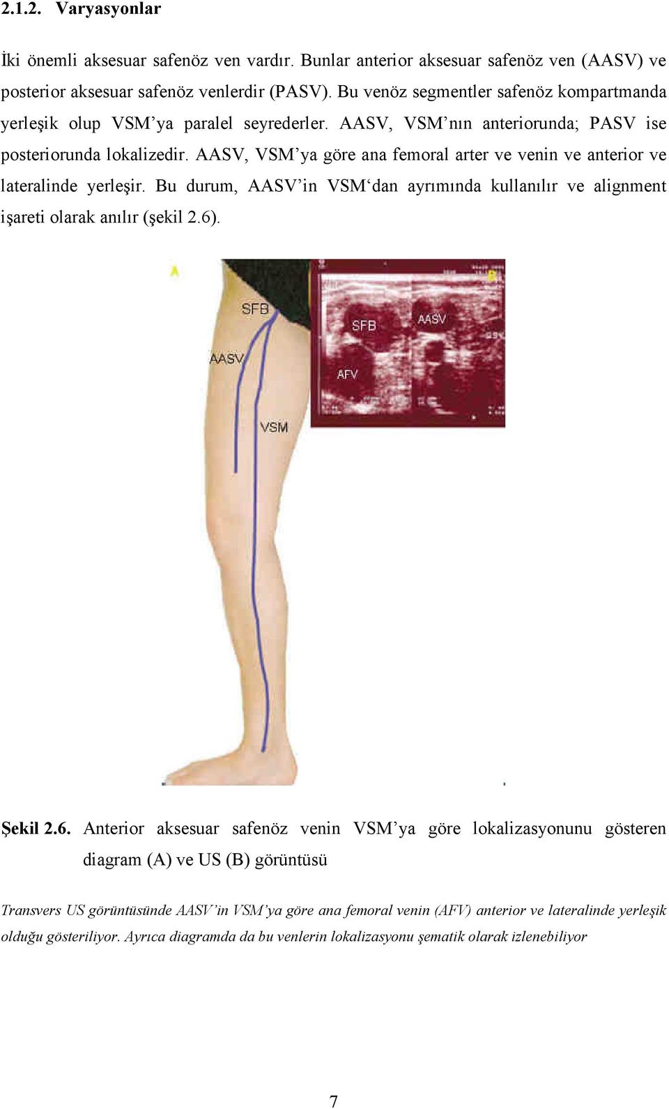 AASV, VSM ya göre ana femoral arter ve venin ve anterior ve lateralinde yerleşir. Bu durum, AASV in VSM dan ayrımında kullanılır ve alignment işareti olarak anılır (şekil 2.6)