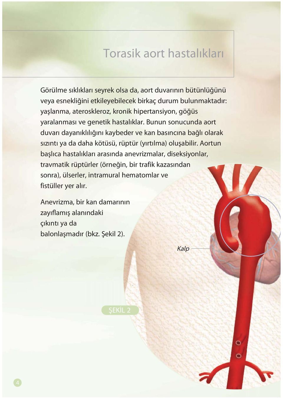 Bunun sonucunda aort duvarı dayanıklılığını kaybeder ve kan basıncına bağlı olarak sızıntı ya da daha kötüsü, rüptür (yırtılma) oluşabilir.