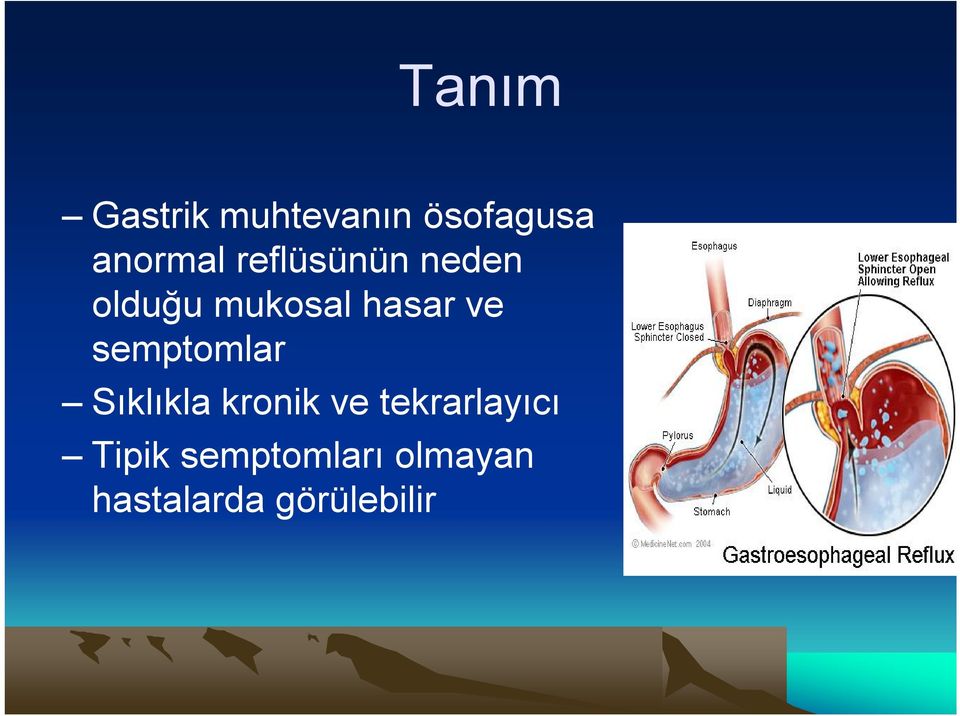 semptomlar Sıklıkla kronik ve tekrarlayıcı