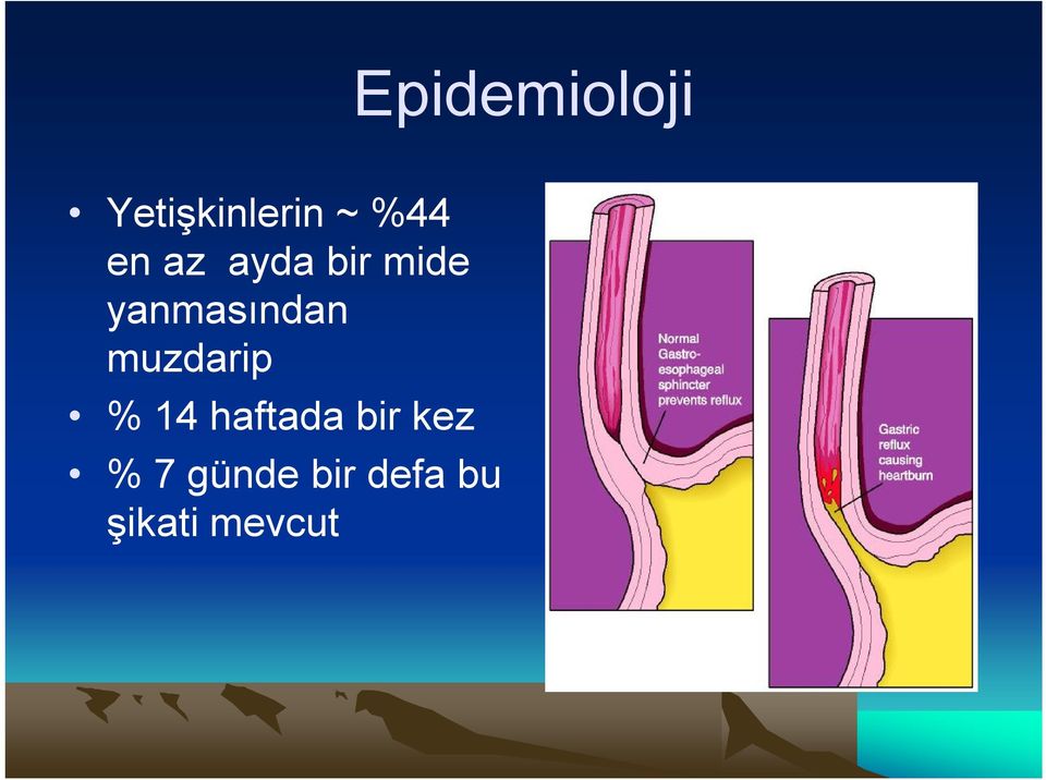 muzdarip % 14 haftada bir kez %