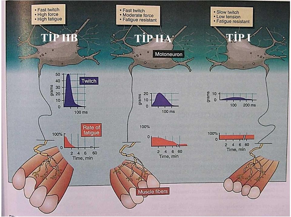 TİP I