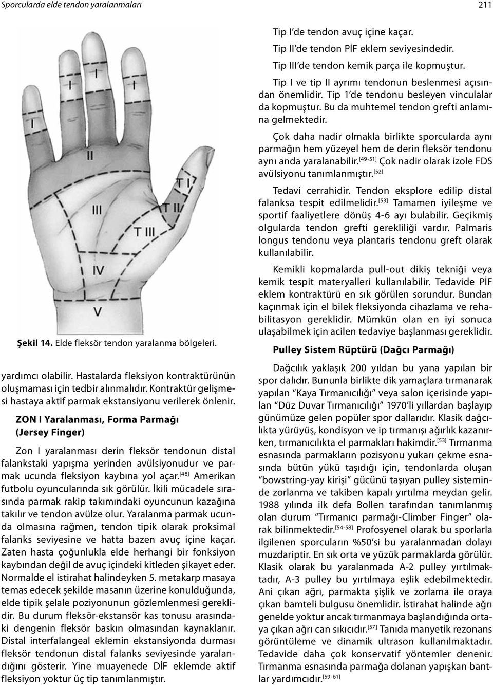 ZON I Yaralanması, Forma Parmağı (Jersey Finger) Zon I yaralanması derin fleksör tendonun distal falankstaki yapışma yerinden avülsiyonudur ve parmak ucunda fleksiyon kaybına yol açar.