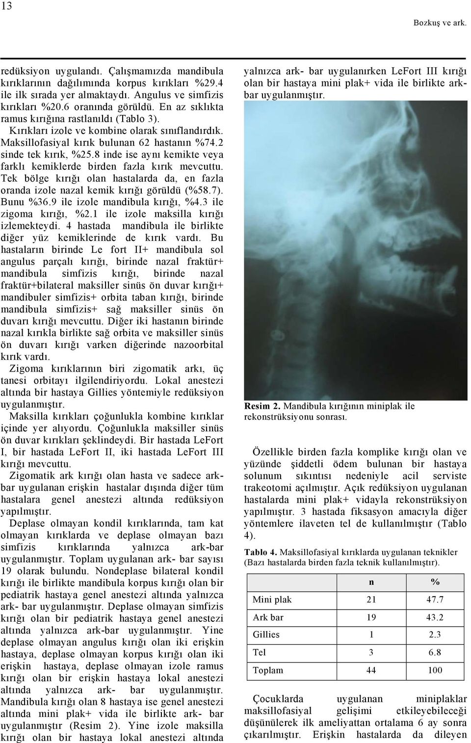 8 inde ise aynı kemikte veya farklı kemiklerde birden fazla kırık mevcuttu. Tek bölge kırığı olan hastalarda da, en fazla oranda izole nazal kemik kırığı görüldü (%58.7). Bunu %36.