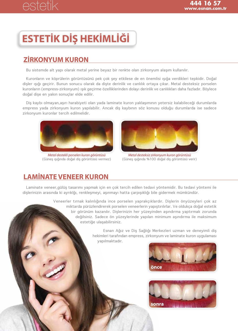 Metal desteksiz porselen kuronların (empress-zirkonyum) ışık geçirme özelliklerinden dolayı derinlik ve canlılıkları daha fazladır. Böylece doğal dişe en yakın sonuçlar elde edilir.