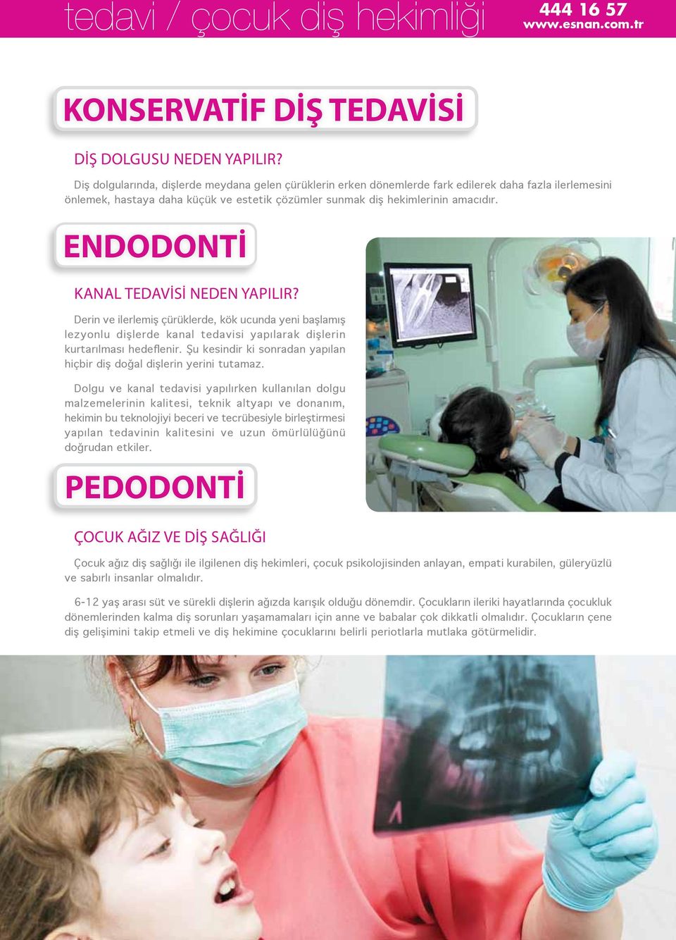 ENDODONTİ KANAL TEDAVİSİ NEDEN YAPILIR? Derin ve ilerlemiş çürüklerde, kök ucunda yeni başlamış lezyonlu dişlerde kanal tedavisi yapılarak dişlerin kurtarılması hedeflenir.