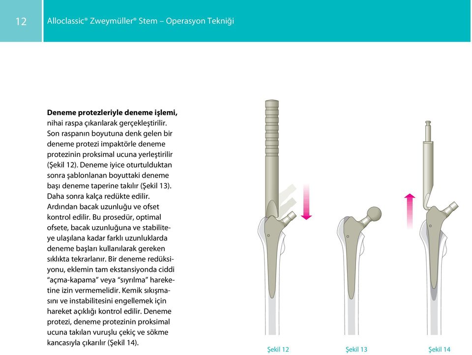 Deneme iyice oturtulduktan sonra şablonlanan boyuttaki deneme başı deneme taperine takılır (Şekil 13). Daha sonra kalça redükte edilir. Ardından bacak uzunluğu ve ofset kontrol edilir.