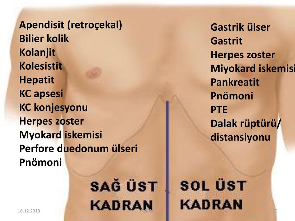 duedonum ülseri Pnömoni PTE Gastrik ülser Gastrit Herpes zoster