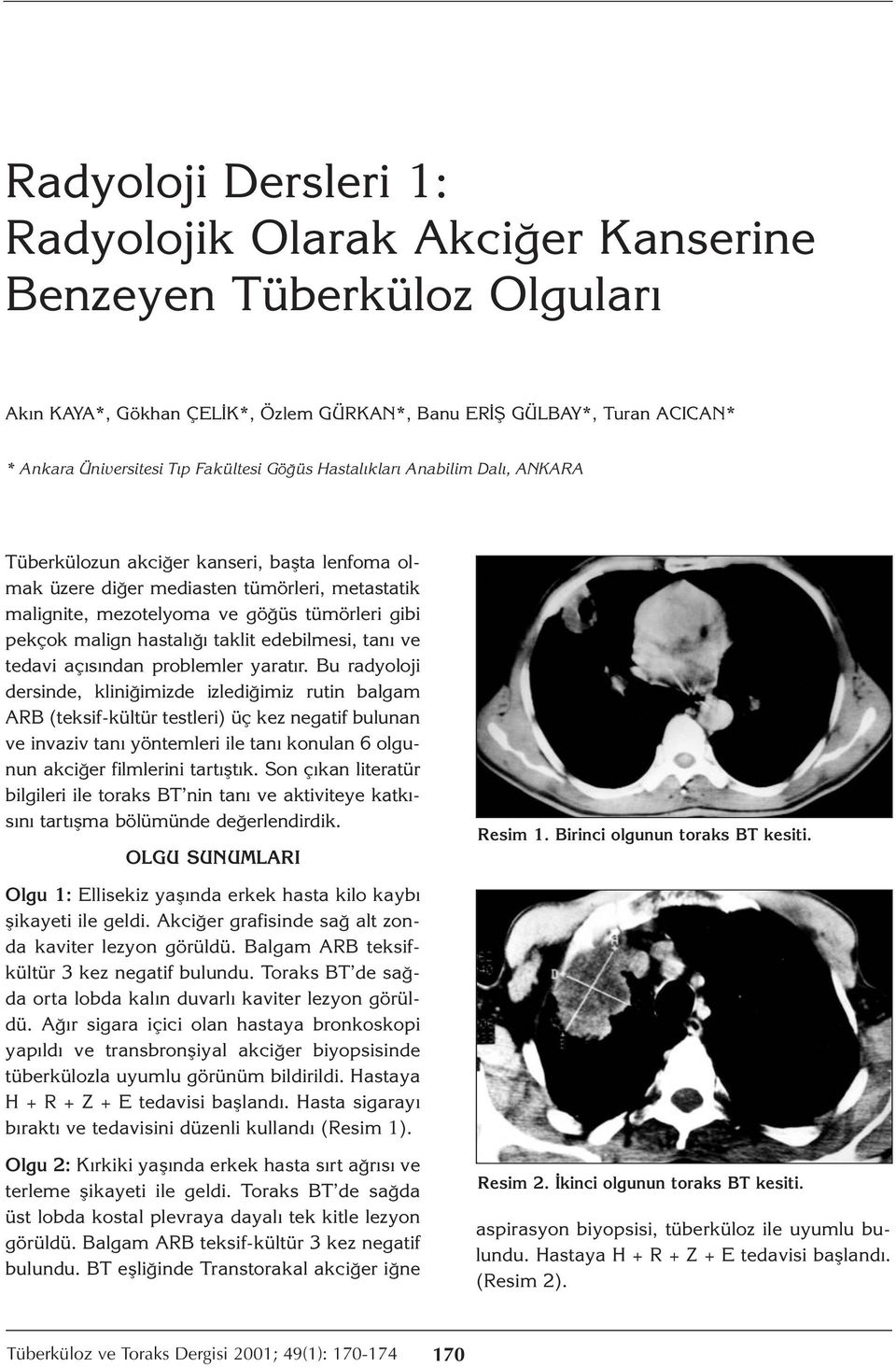 hastalığı taklit edebilmesi, tanı ve tedavi açısından problemler yaratır.