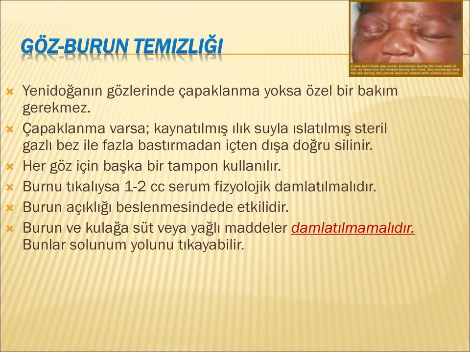 silinir. Her göz için başka bir tampon kullanılır. Burnu tıkalıysa 1-2 cc serum fizyolojik damlatılmalıdır.