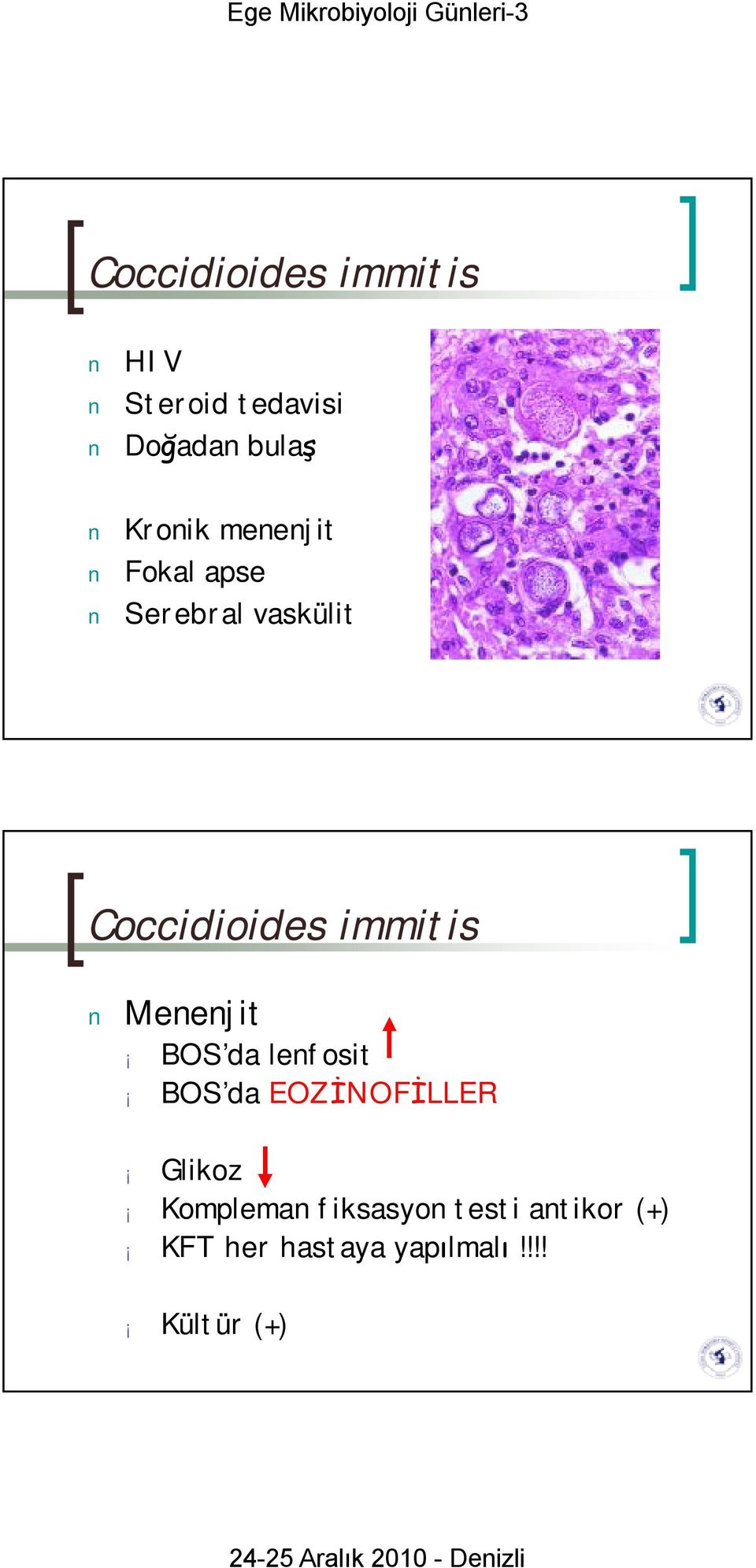 Menenjit BOS da lenfosit BOS da EOZİNOFİLLER Glikoz Kompleman