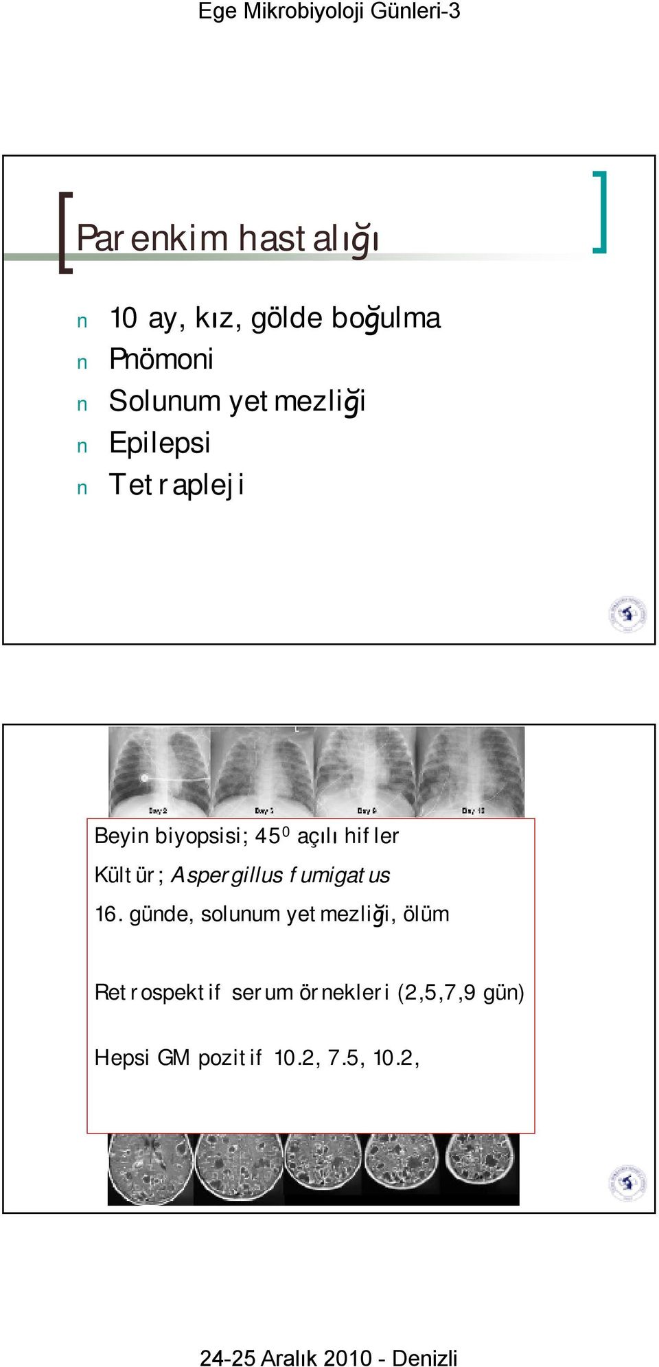 Kültür; Aspergillus fumigatus 16.