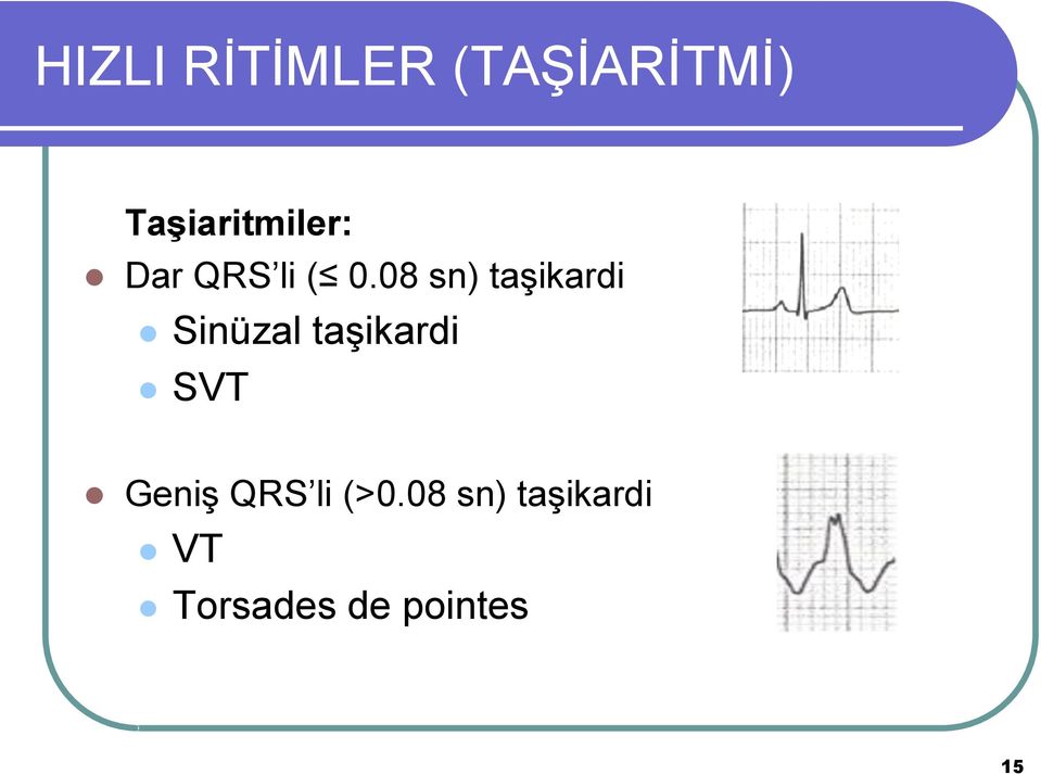 08 sn) taģikardi Sinüzal taģikardi SVT