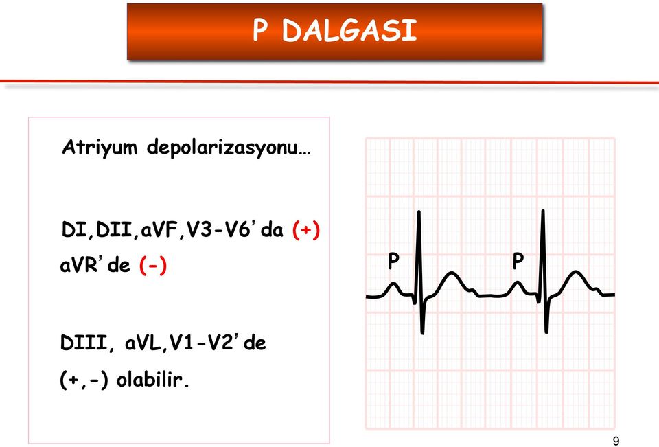 DI,DII,aVF,V3-V6 da (+) avr