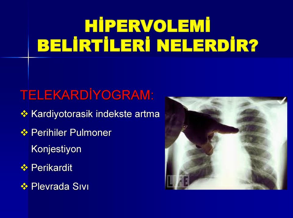 indekste artma Perihiler Pulmoner