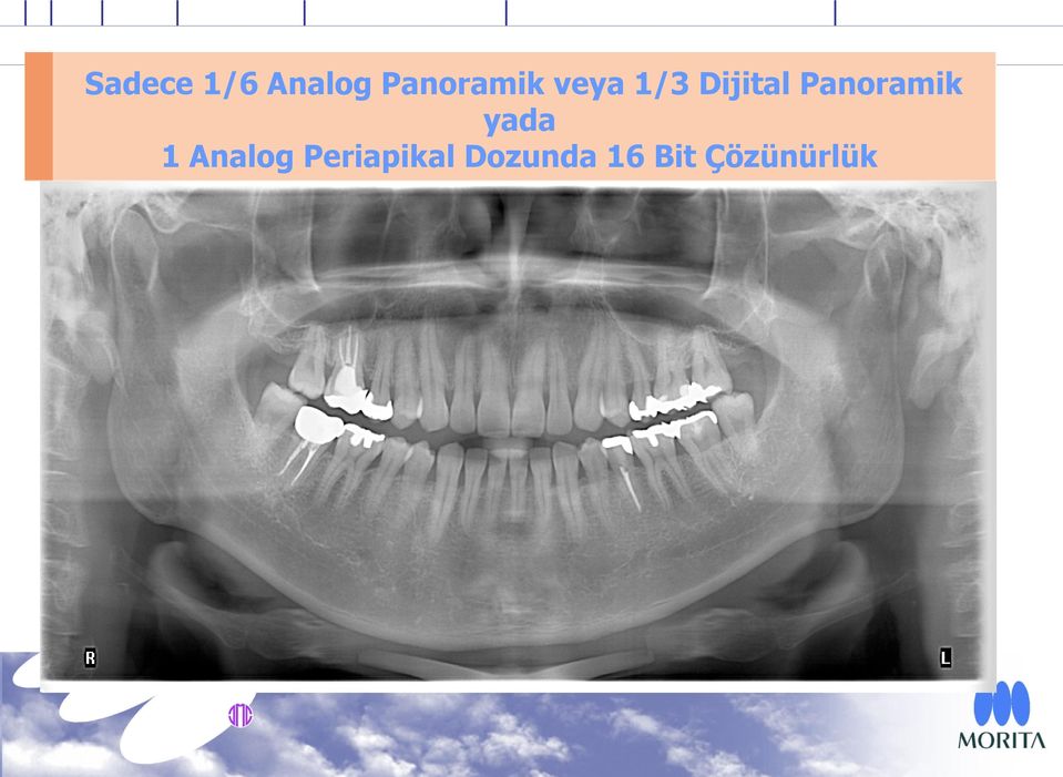 Panoramik yada 1 Analog