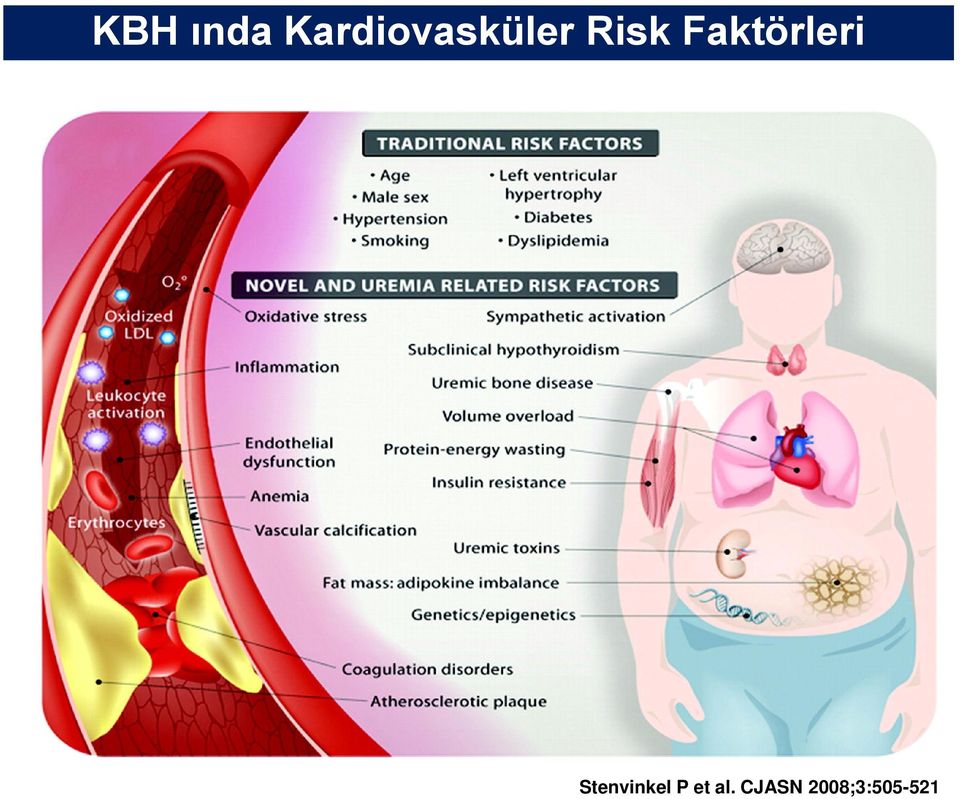 Faktörleri