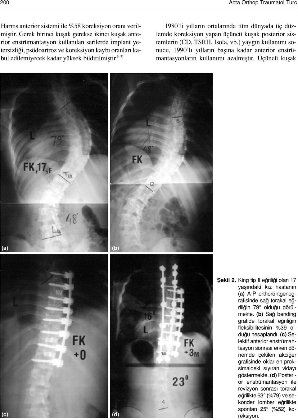 [4-7] 1980 li y llar n ortalar nda tüm dünyada üç düzlemde koreksiyon yapan üçüncü kuflak posterior sistemlerin (CD, TSRH, Isola, vb.