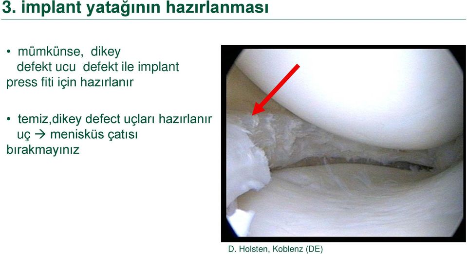 hazırlanır temiz,dikey defect uçları hazırlanır