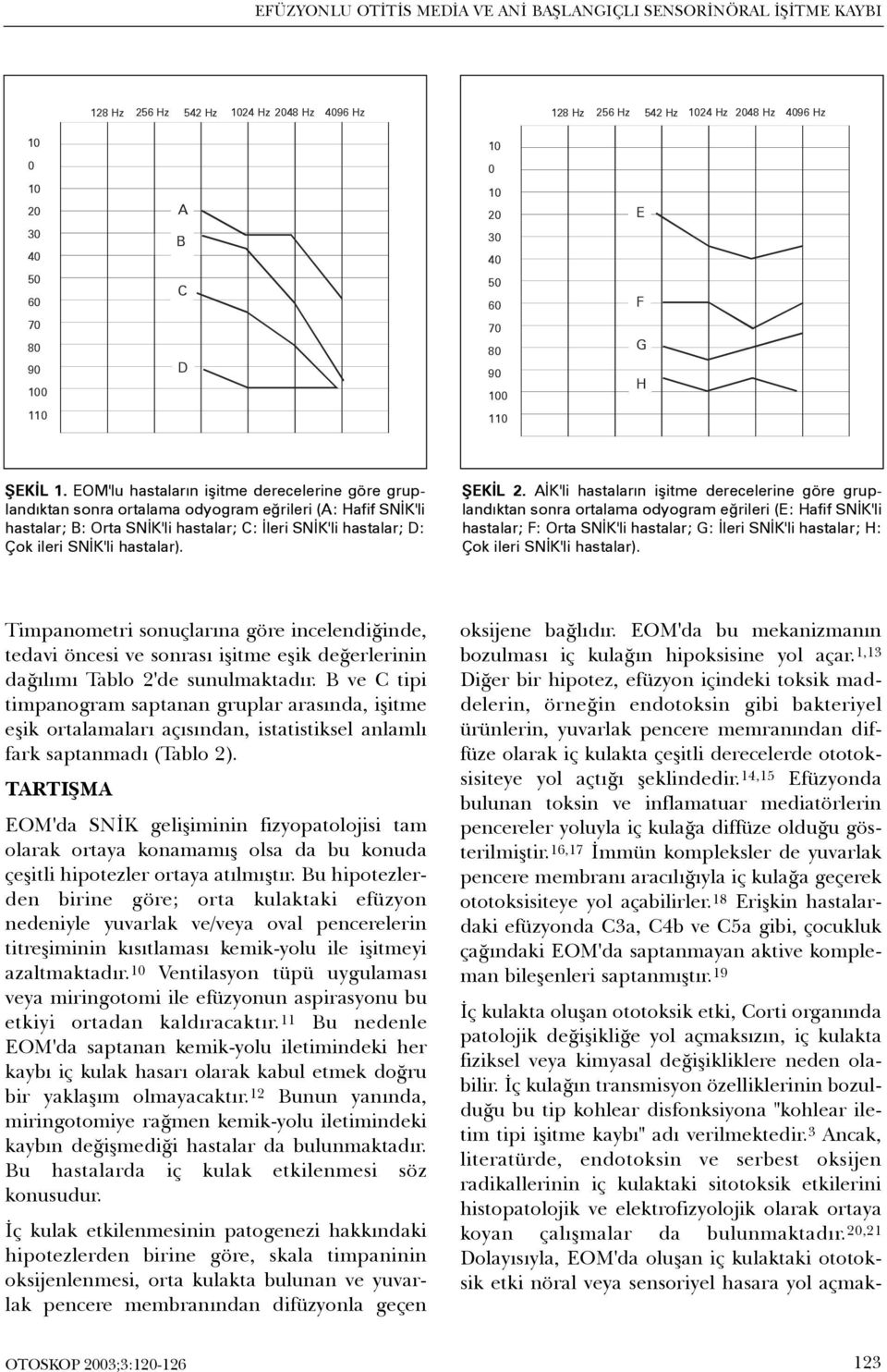 EOM'lu hastalarýn iþitme derecelerine göre gruplandýktan sonra ortalama odyogram eðrileri (A: Hafif SNÝK'li hastalar; B: Orta SNÝK'li hastalar; C: Ýleri SNÝK'li hastalar; D: Çok ileri SNÝK'li