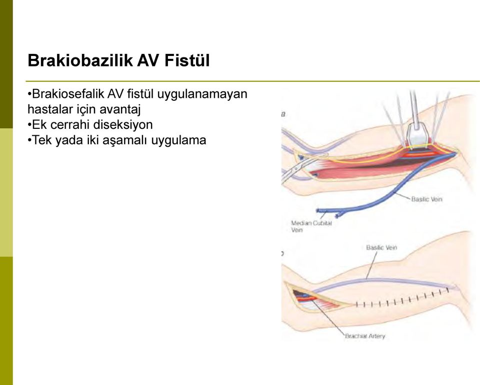 uygulanamayan hastalar için