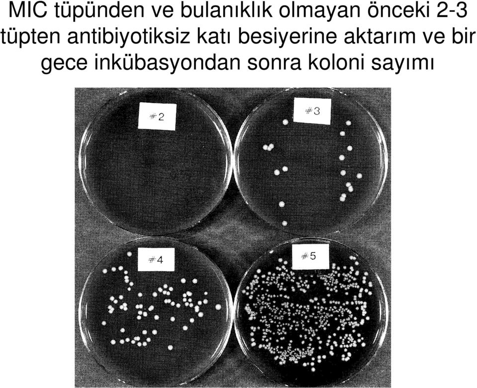 katı besiyerine aktarım ve bir