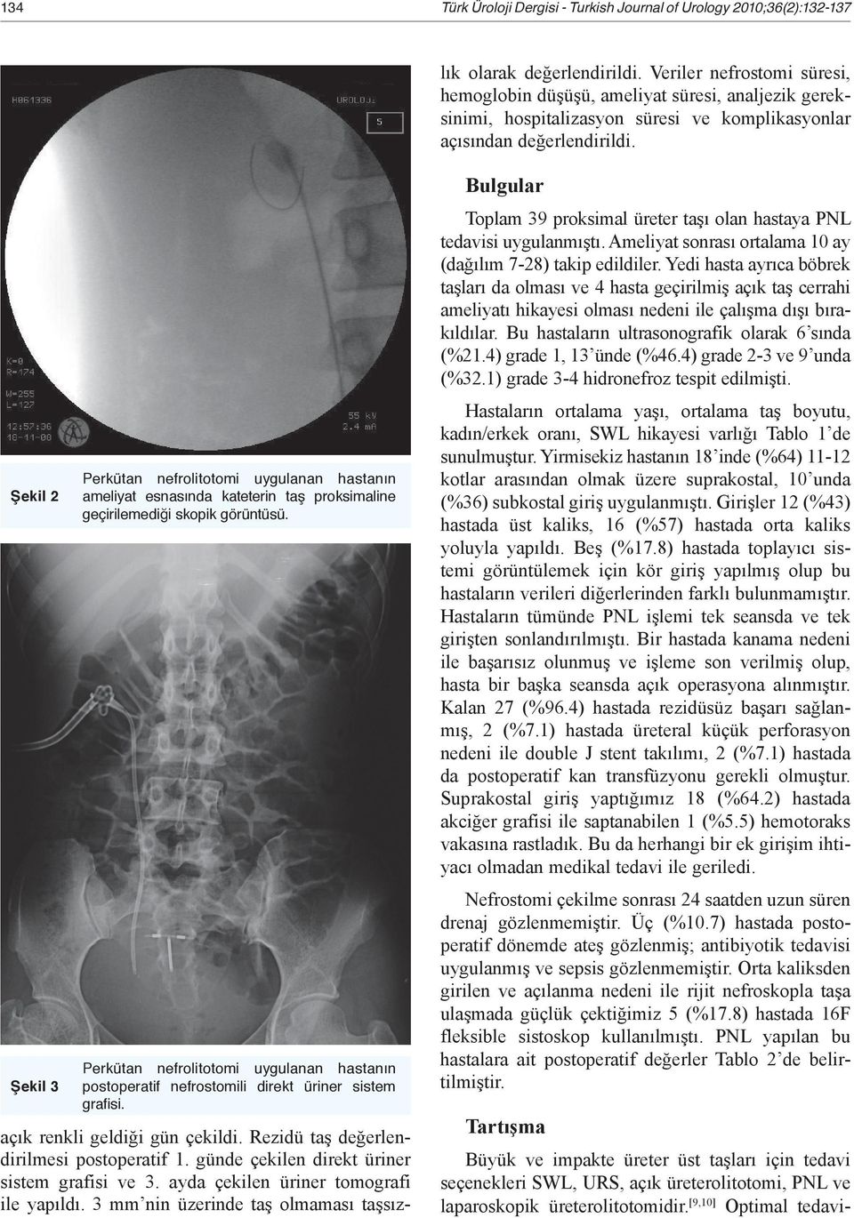 Veriler nefrostomi süresi, hemoglobin düşüşü, ameliyat süresi, analjezik gereksinimi, hospitalizasyon süresi ve komplikasyonlar açısından değerlendirildi.