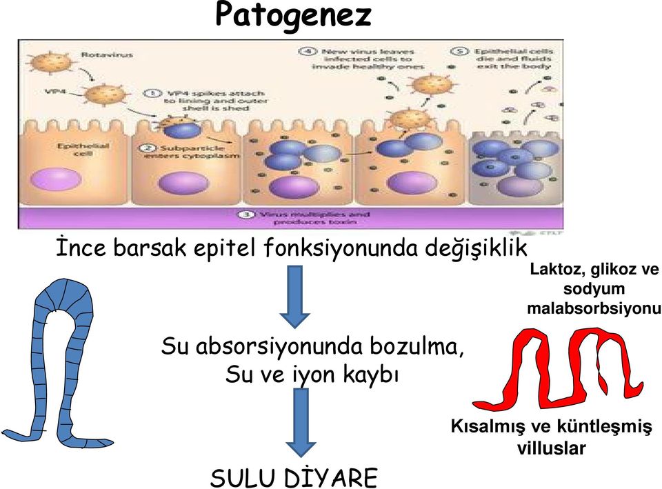 iyon kaybı Laktoz, glikoz ve sodyum