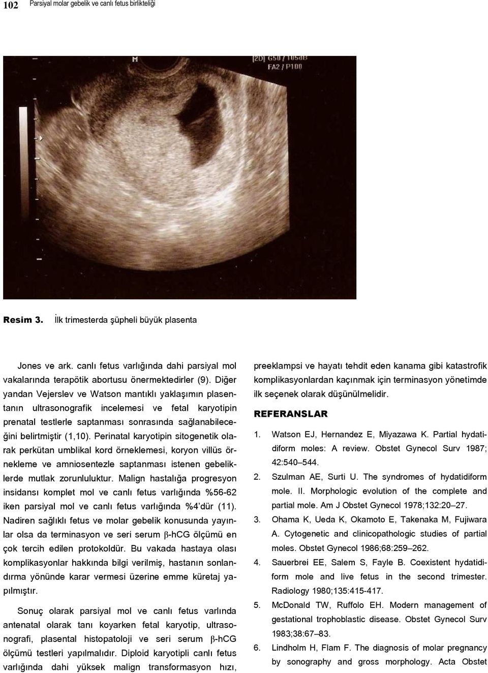 Diğer yandan Vejerslev ve Watson mantıklı yaklaşımın plasentanın ultrasonografik incelemesi ve fetal karyotipin prenatal testlerle saptanması sonrasında sağlanabileceğini belirtmiştir (1,10).