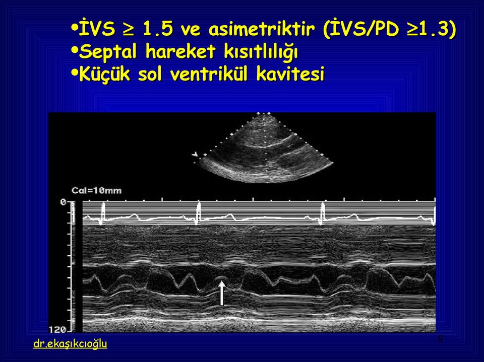 (İVS/PD 1.