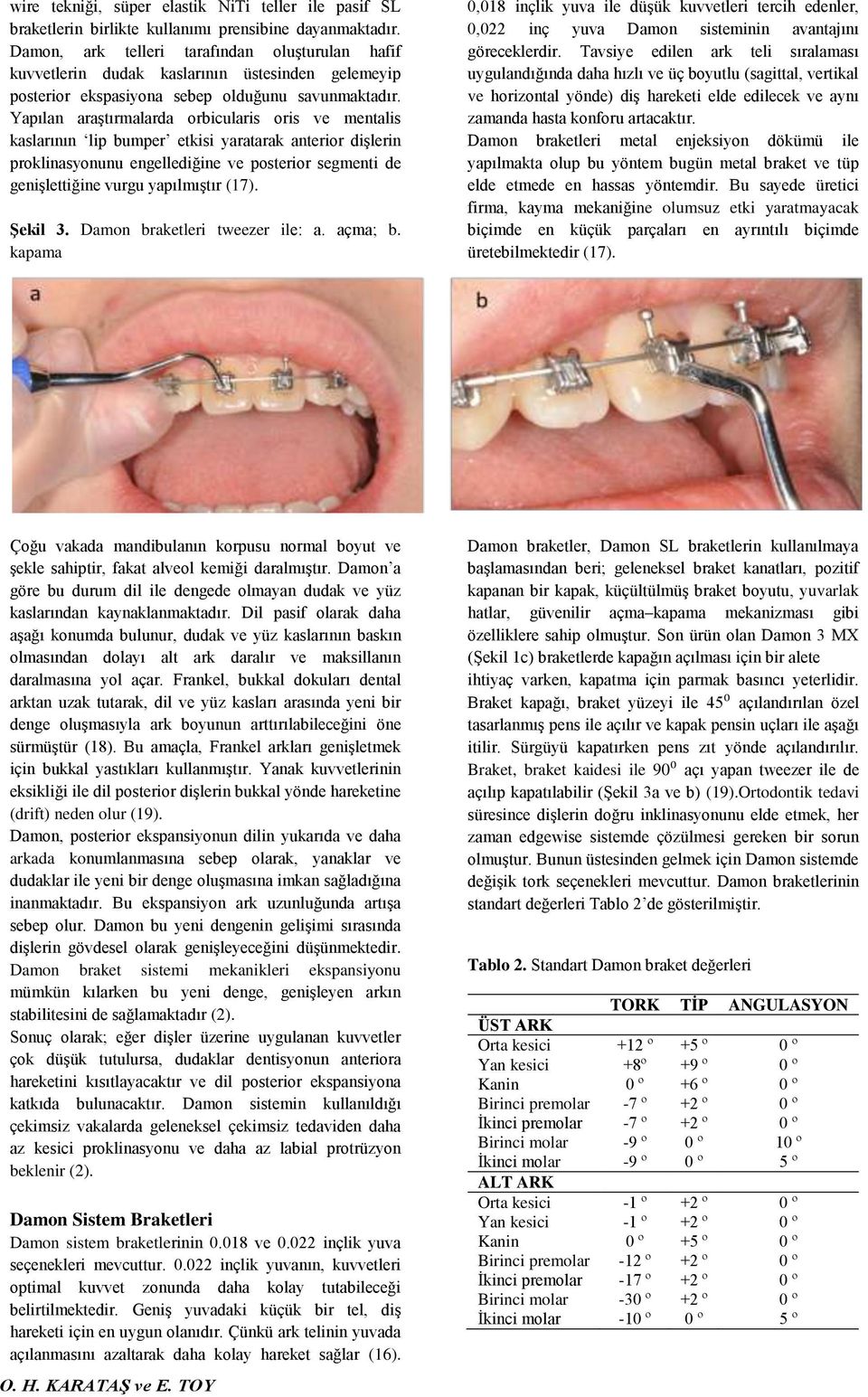 Yapılan araştırmalarda orbicularis oris ve mentalis kaslarının lip bumper etkisi yaratarak anterior dişlerin proklinasyonunu engellediğine ve posterior segmenti de genişlettiğine vurgu yapılmıştır