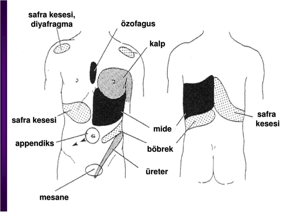 kesesi appendiks mide