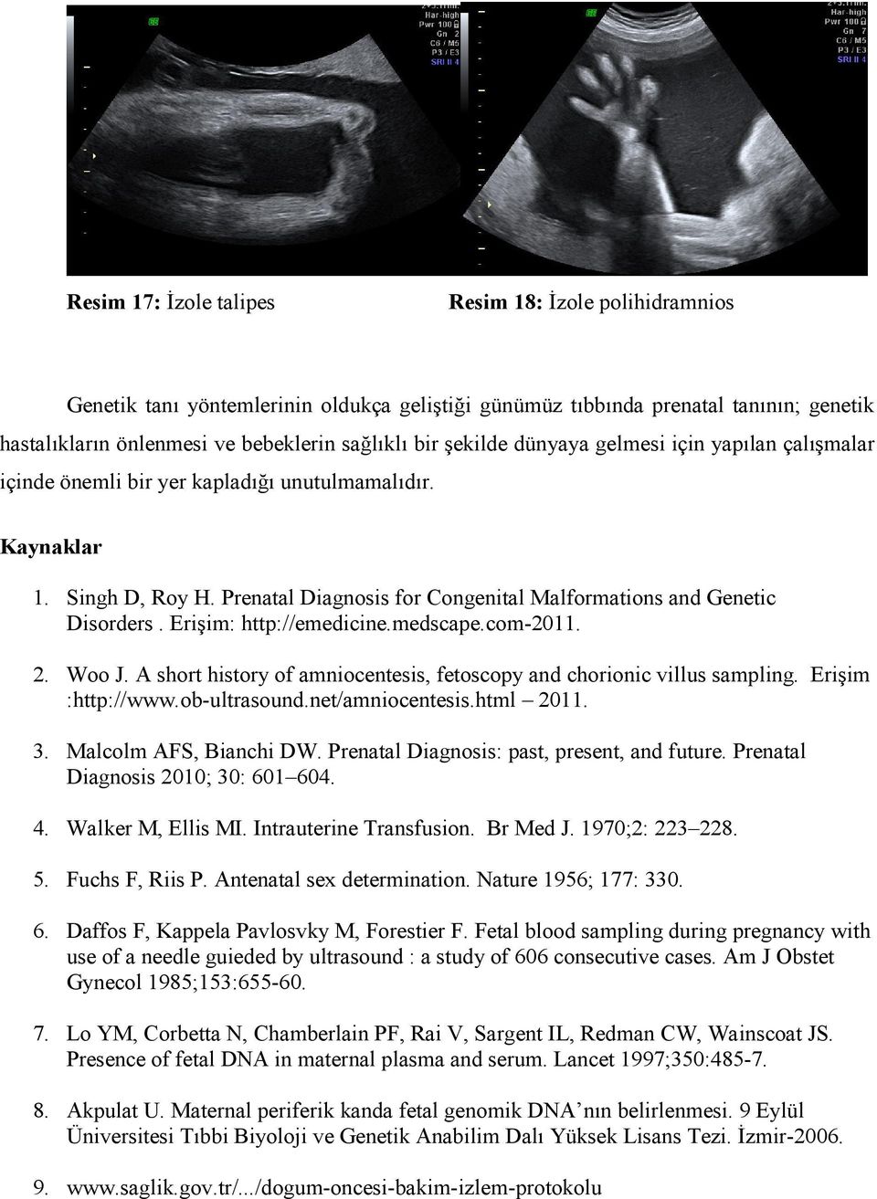 Erişim: http://emedicine.medscape.com-2011. 2. Woo J. A short history of amniocentesis, fetoscopy and chorionic villus sampling. Erişim :http://www.ob-ultrasound.net/amniocentesis.html 2011. 3.