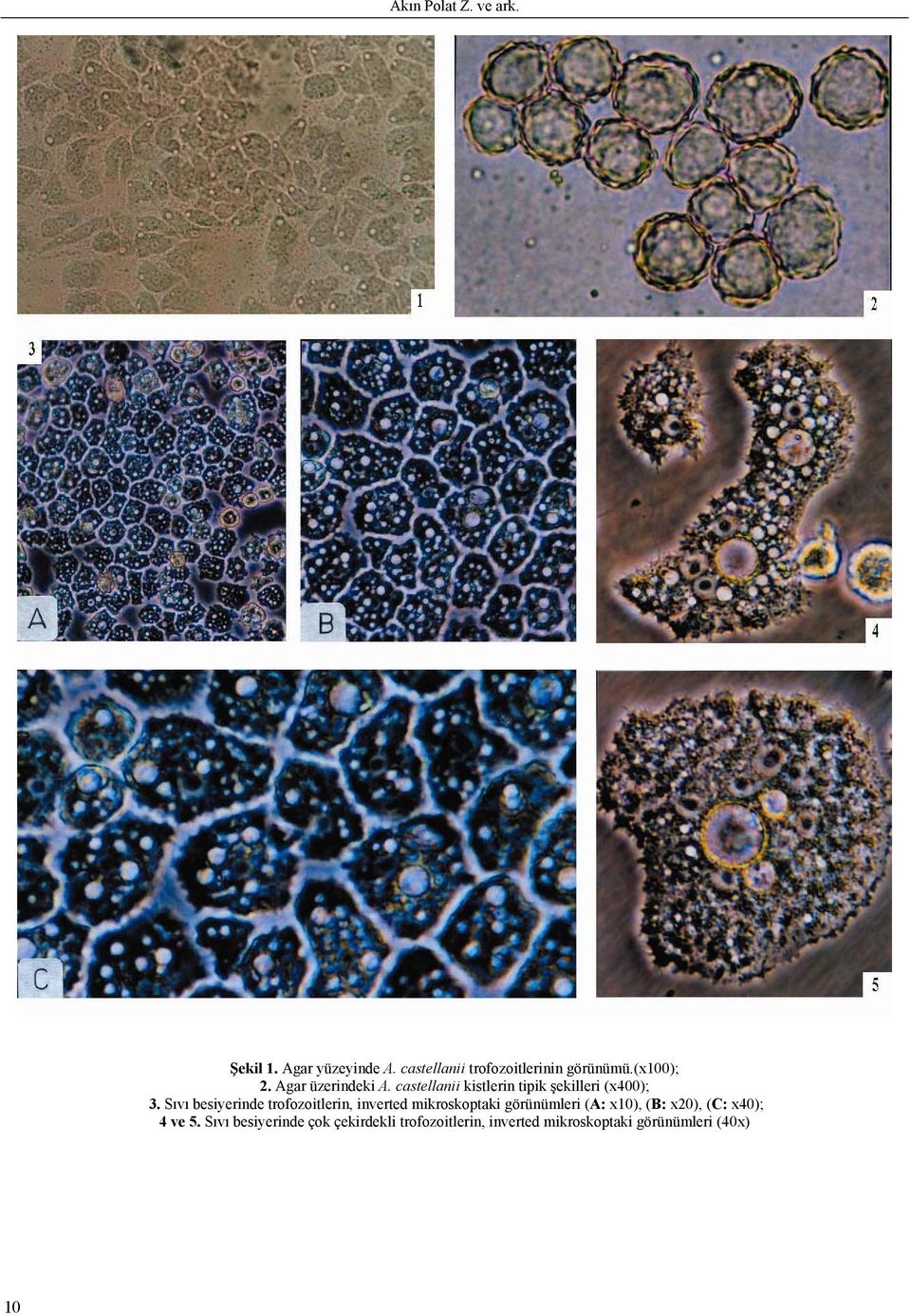 Sıvı besiyerinde trofozoitlerin, inverted mikroskoptaki görünümleri (A: x10), (B: x20),