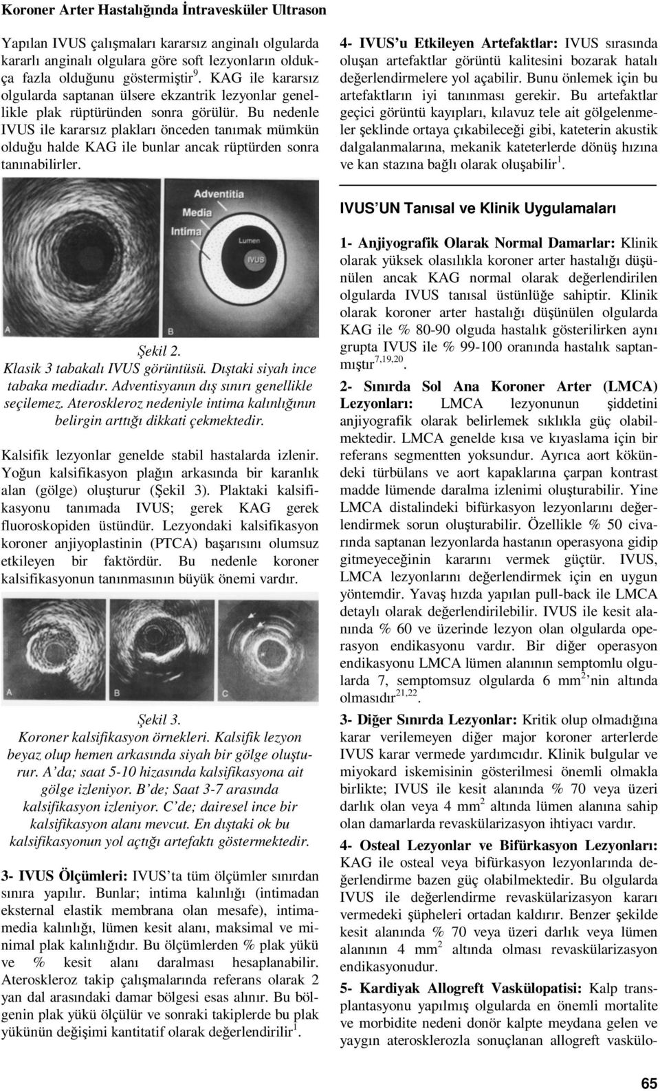 Bu nedenle IVUS ile kararsız plakları önceden tanımak mümkün olduğu halde KAG ile bunlar ancak rüptürden sonra tanınabilirler.