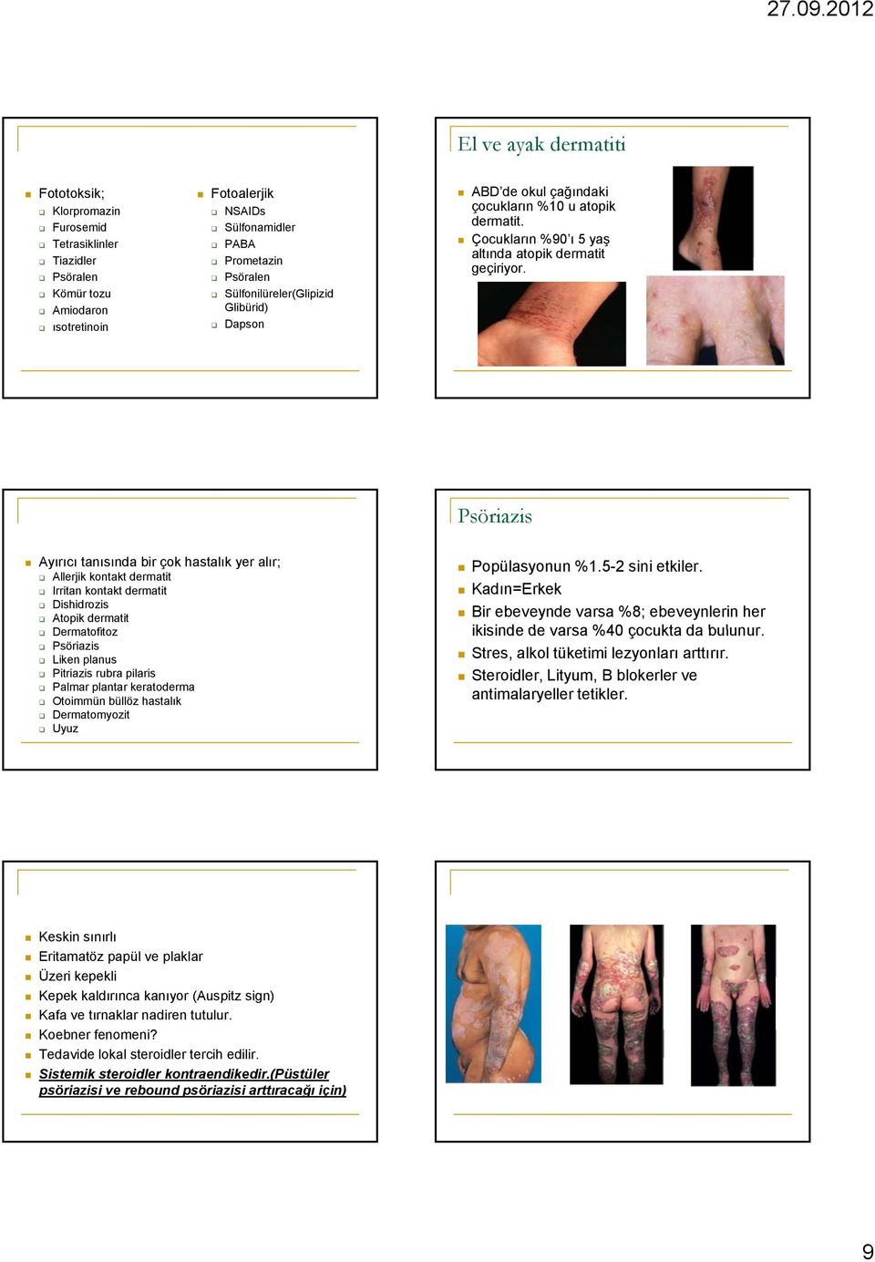 Psöriazis Ayırıcı tanısında bir çok hastalık yer alır; Allerjik kontakt dermatit Irritan kontakt dermatit Dishidrozis Atopik dermatit Dermatofitoz Psöriazis Liken planus Pitriazis rubra pilaris