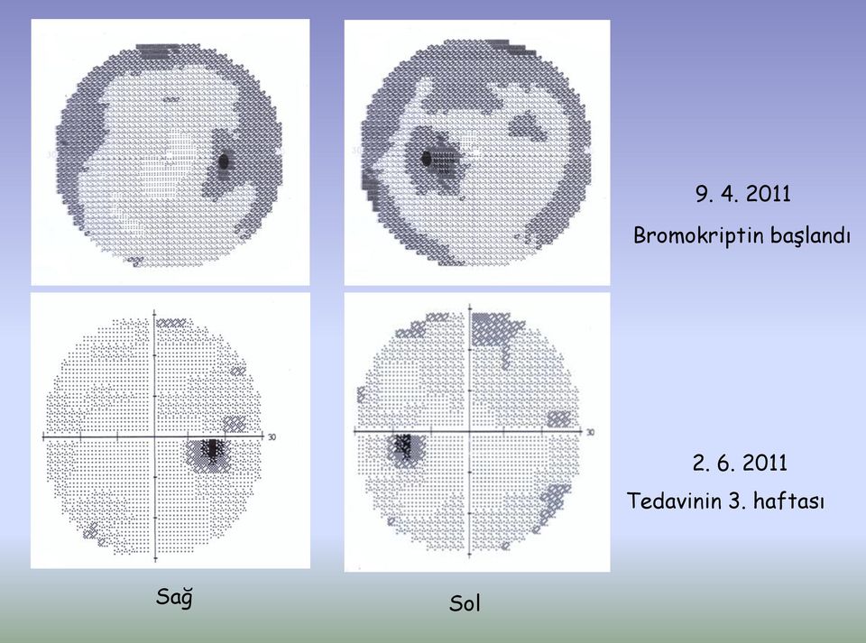 başlandı 2. 6.