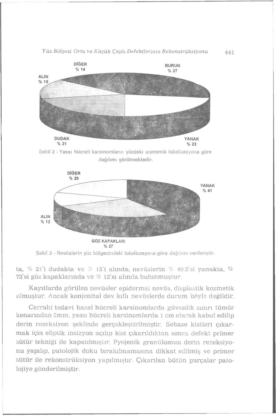 2'si yanakta, % 72'si göz kapaklarında ve % 12'si alında bulunmuştur. Kayıtlarda, görülen nevüsler epidermal nevüs, displastik kozmetik olmuştur.