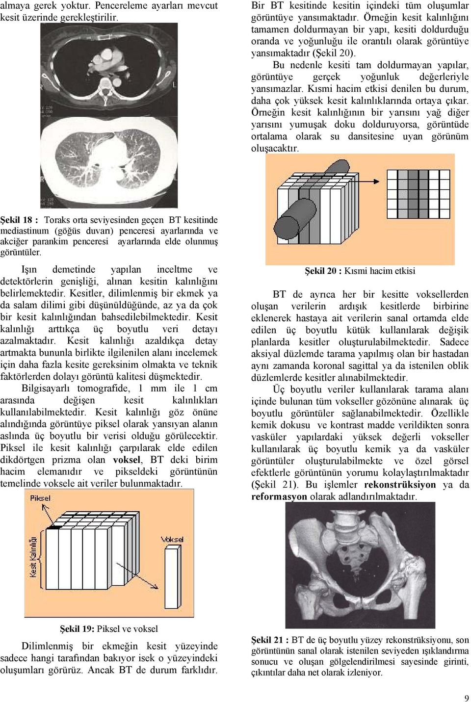 Bu nedenle kesiti tam doldurmayan yapılar, görüntüye gerçek yoğunluk değerleriyle yansımazlar. Kısmi hacim etkisi denilen bu durum, daha çok yüksek kesit kalınlıklarında ortaya çıkar.