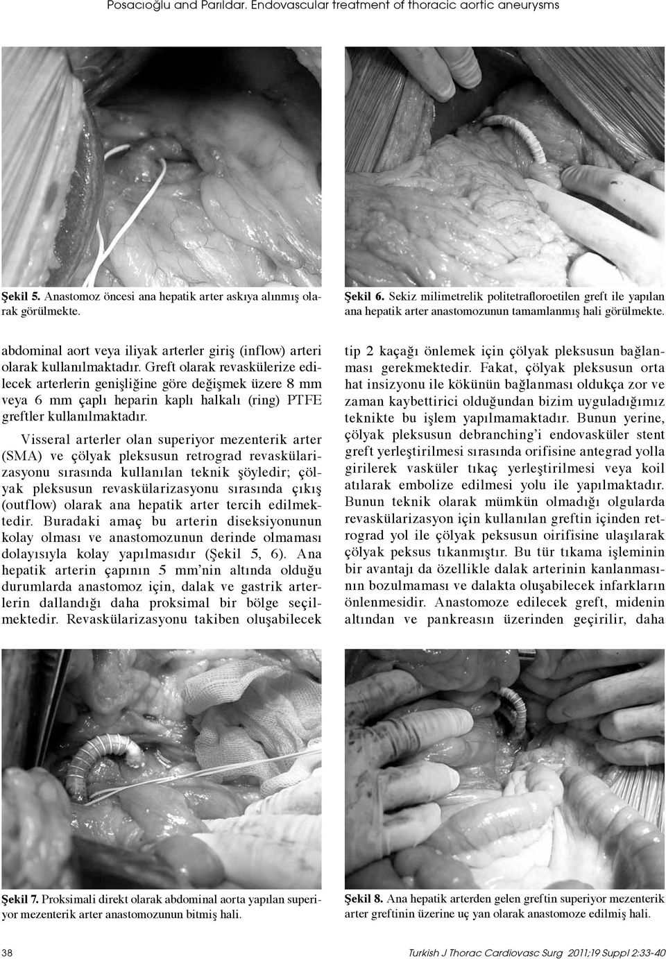 abdominal aort veya iliyak arterler giriş (inflow) arteri olarak kullanılmaktadır.