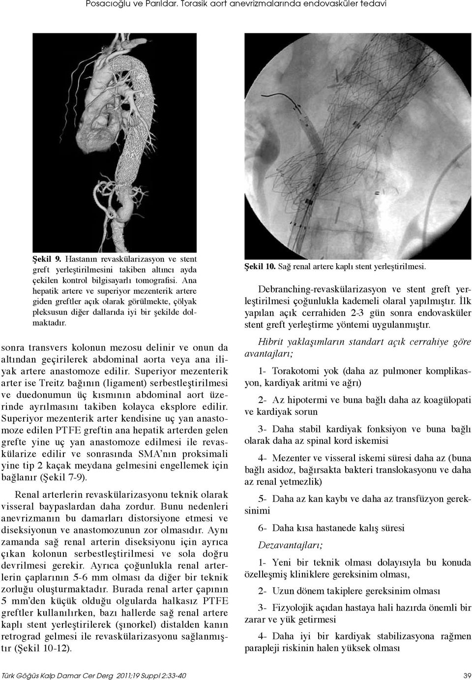 Ana hepatik artere ve superiyor mezenterik artere giden greftler açık olarak görülmekte, çölyak pleksusun diğer dallarıda iyi bir şekilde dolmaktadır.
