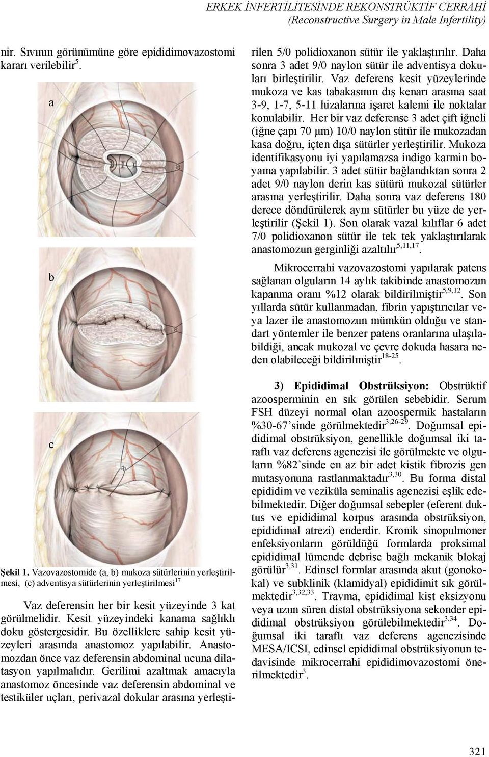 Kesit yüzeyindeki kanama sağlıklı doku göstergesidir. Bu özelliklere sahip kesit yüzeyleri arasında anastomoz yapılabilir. Anastomozdan önce vaz deferensin abdominal ucuna dilatasyon yapılmalıdır.