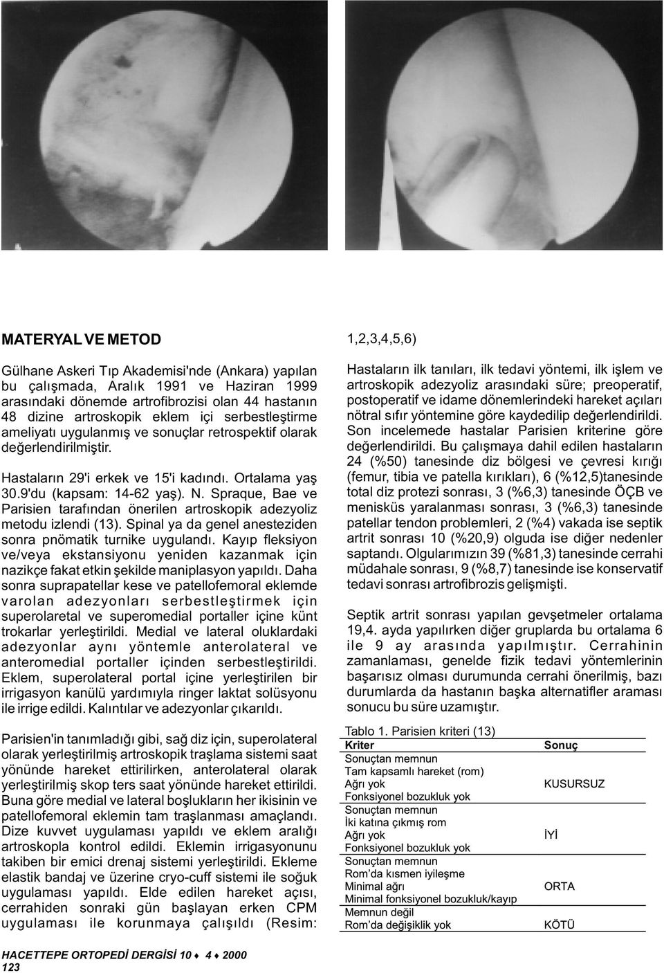 Spraque, Bae ve Parisien tarafýndan önerilen artroskopik adezyoliz metodu izlendi (13). Spinal ya da genel anesteziden sonra pnömatik turnike uygulandý.